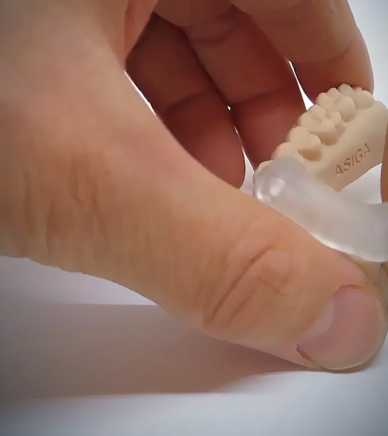 A 3D-printed implant surgical guide being fitted onto a dental model.